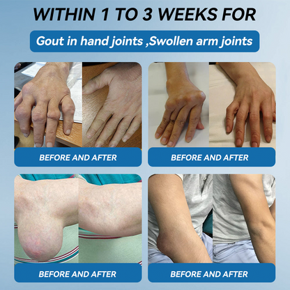 Lotmay® BPC-157 Joint Therapy Cream ⚡For Treats Arthritis, Neuropathy, Rheumatism, Sports Injuries & More