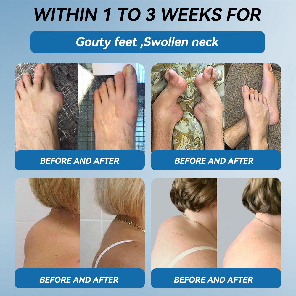 Lotmay® BPC-157 Joint Therapy Cream ⚡For Treats Arthritis, Neuropathy, Rheumatism, Sports Injuries & More