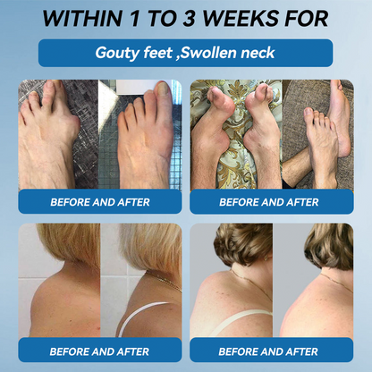 Lotmay® BPC-157 Joint Therapy Cream ⚡For Treats Arthritis, Neuropathy, Rheumatism, Sports Injuries & More