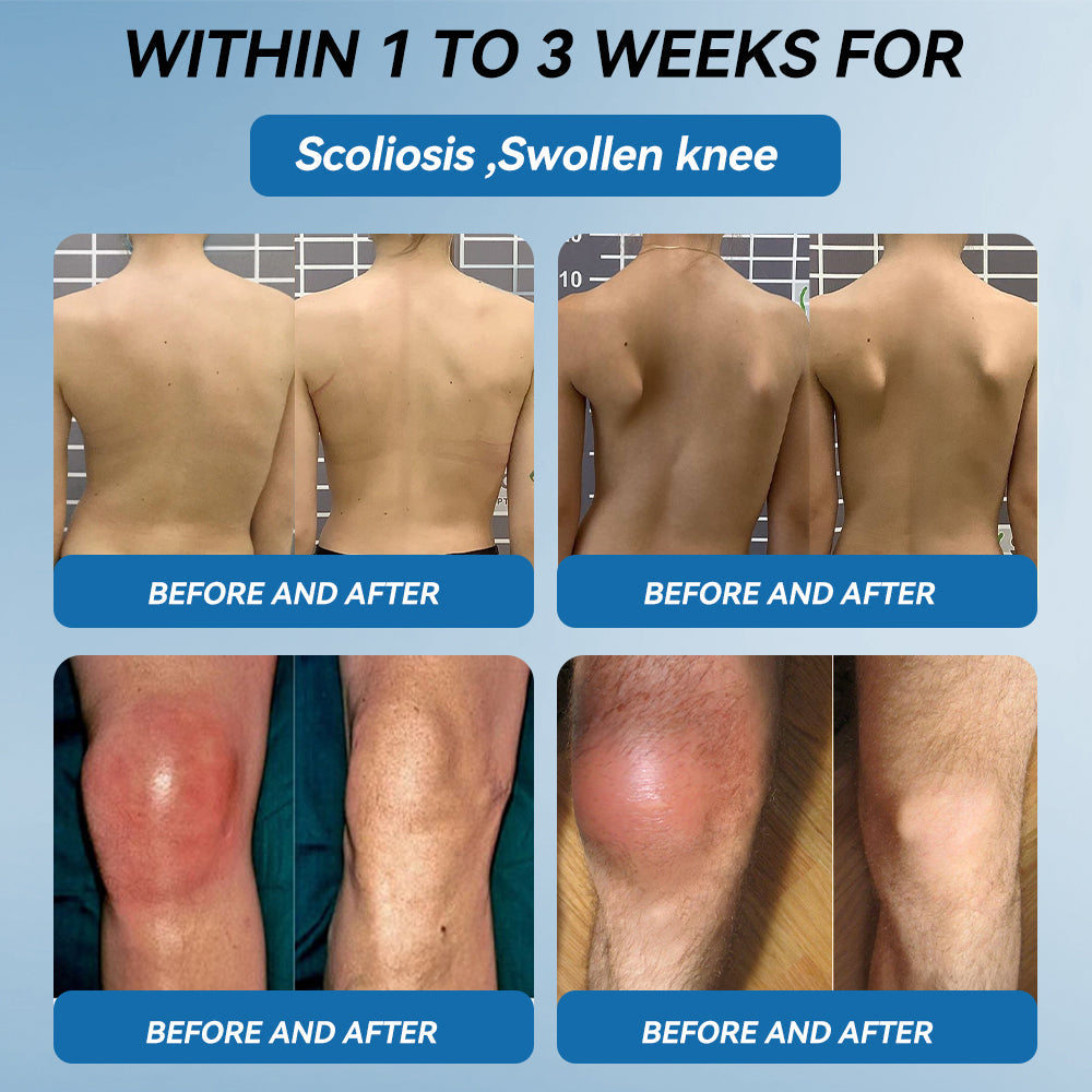 Lotmay® BPC-157 Joint Therapy Cream ⚡For Treats Arthritis, Neuropathy, Rheumatism, Sports Injuries & More