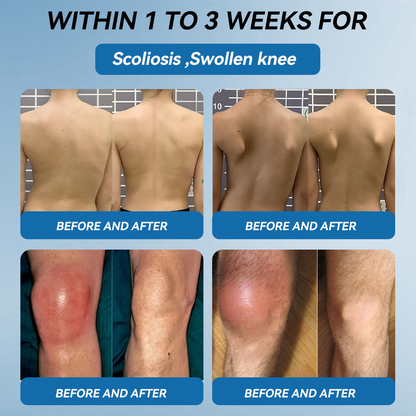 Lotmay® BPC-157 Joint Therapy Cream ⚡For Treats Arthritis, Neuropathy, Rheumatism, Sports Injuries & More