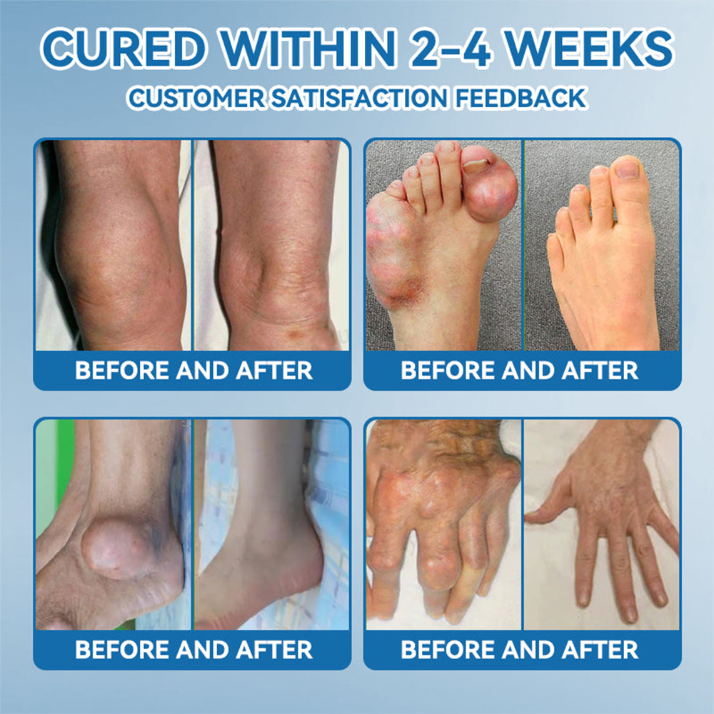 Lotmay® BPC-157 Joint Therapy Cream ⚡For Treats Arthritis, Neuropathy, Rheumatism, Sports Injuries & More