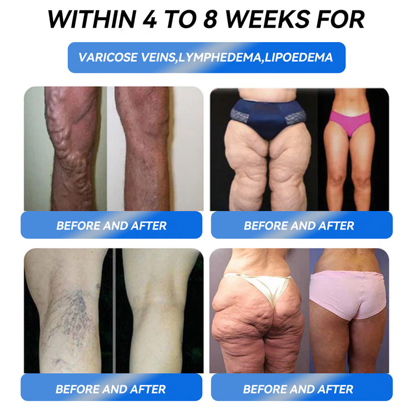 Honxi® ⚡⚡GLP-1 Max Weight Loss Oral Solution ✅See results in 7 days 👩‍⚕️Suitable for obesity, cardiovascular diseases, diabetes, sleep apnea, high cholesterol and blood lipids, joint problems, and various other conditions🚀
