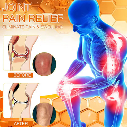 ✅Official Store: Lotmay™ Bee-Venom Pain-Relief Bone Healing Cream (👨‍⚕️Reducing joint swelling, pain, stiffness, redness, warmth, soreness, and joint fatigue)