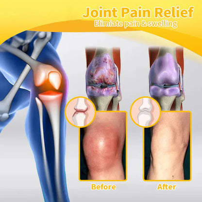 ✅Official Store: Lotmay™ Bee-Venom Pain-Relief Bone Healing Cream (👨‍⚕️Reducing joint swelling, pain, stiffness, redness, warmth, soreness, and joint fatigue)