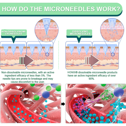 Honxi® Tirzepatide Slimming & health NANO MICRONEEDLE PATCH 👩‍⚕️Suitable for obesity, cardiovascular diseases, diabetes, sleep apnea, high cholesterol and blood lipids, joint problems, and various other conditions