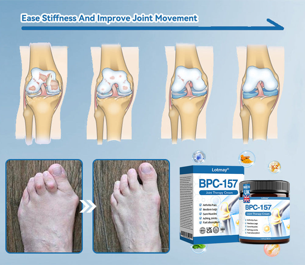 Lotmay® BPC-157 Joint Therapy Cream ⚡For Treats Arthritis, Neuropathy, Rheumatism, Sports Injuries & More