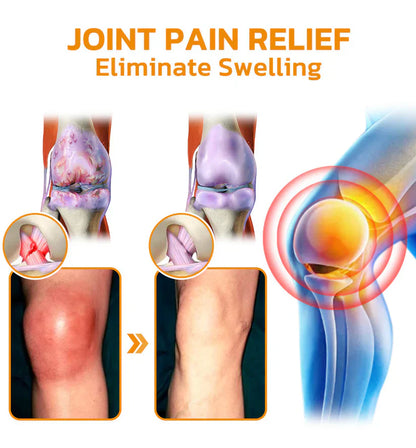 ✅Official Store: Lotmay™ Bee-Venom Pain-Relief Bone Healing Cream (👨‍⚕️Reducing joint swelling, pain, stiffness, redness, warmth, soreness, and joint fatigue)