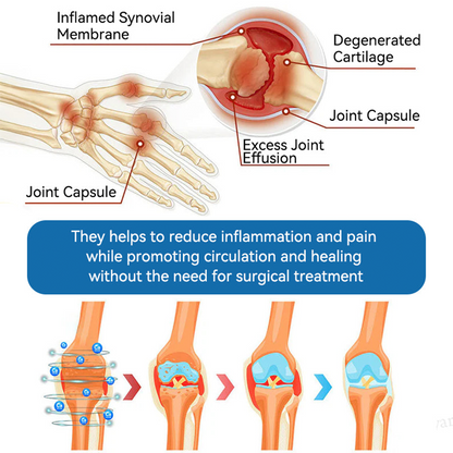 Lotmay® BPC-157 Joint Therapy Cream ⚡For Treats Arthritis, Neuropathy, Rheumatism, Sports Injuries & More